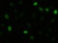 AKT3 Antibody (clone 9H8)
